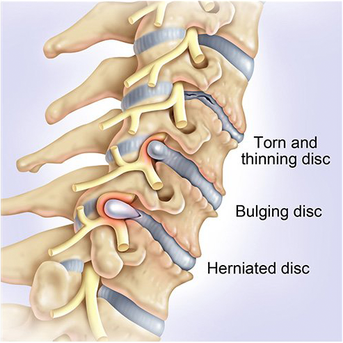 Spine Motion Matters - Spine & Orthopedic Specialists Tulsa